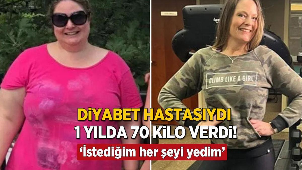 Diyabet hastasıydı, bu taktikle 1 yılda 70 kilo verdi! ‘İstediğim her şeyi yedim’